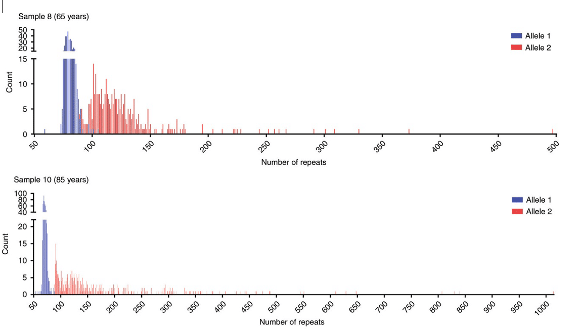 Histograms to illustrate CTG18.1 repeat length distributions for samples harboring biallelic expansions. All sequenced alleles displayed repeat length instability (Hafford-Tear et al., 2019).